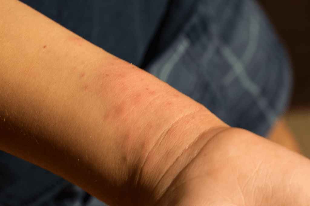 cimice da letto immagini