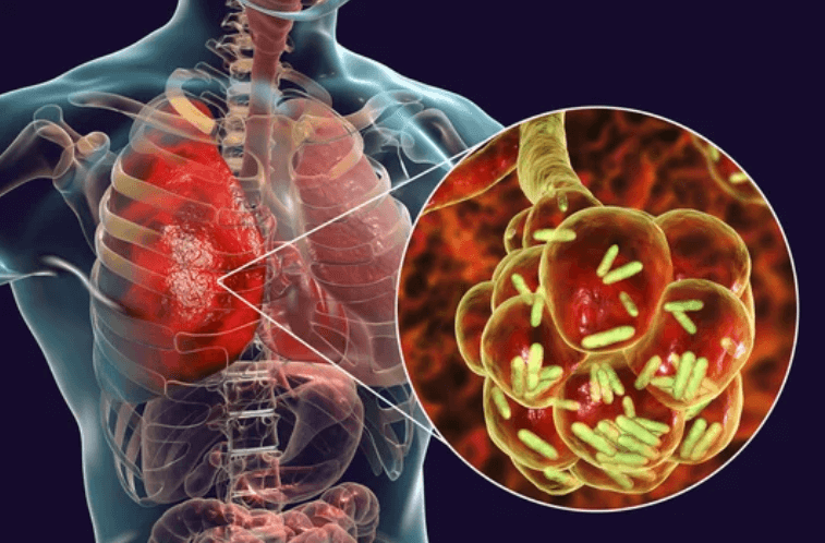 Foto grafica che riproduce gli organi interni umani con un primo piano sui polmoni
